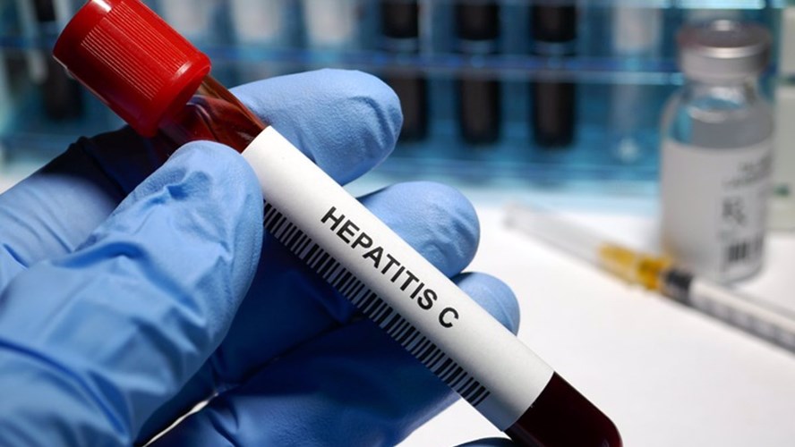 hepatitisc