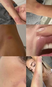 Fuerte denuncia de la expareja de Lautaro Acosta por violencia de género 1 acosta2